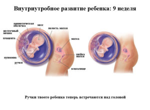 Беременность 8 9 недель развитие