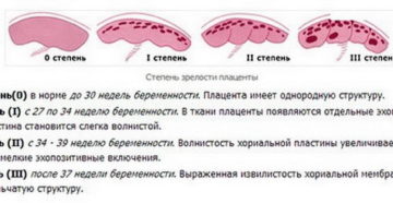 Степень зрелости плаценты 3 на 38 неделе беременности что это значит