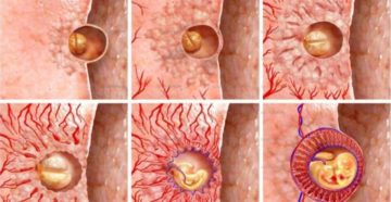 Как после подсадки эмбрион прикрепляется к матке