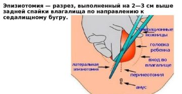 Сколько нельзя сидеть после родов со швами