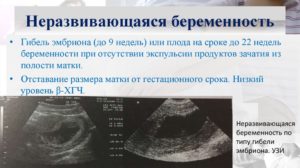 Признаки замершей беременности на 15 неделе