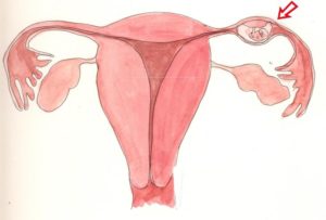 40 Неделя беременности рези во влагалище