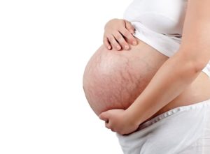 Тянет кожу живота при беременности