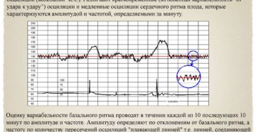 Ктг При Беременности Сколько По Времени Длится