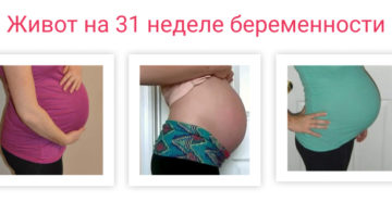 Почему болит живот 31 неделе беременности