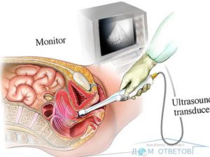Делают ли трансвагинальное узи девственницам