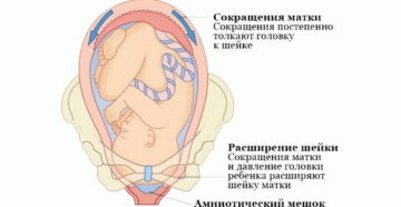 При сокращении матки какие ощущения