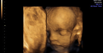 3D узи на 25 неделе беременности фото