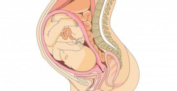 На матку давит при беременности
