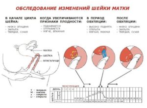 Может Ли Болеть Правый Бок При Овуляции