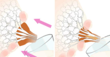 Как правильно сцеживать грудное молоко при мастите