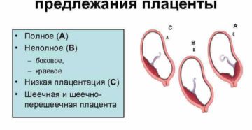 Центральное предлежание плаценты при беременности 20 недель