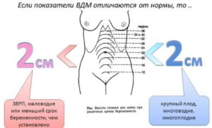 16 Неделя беременности высота дна матки