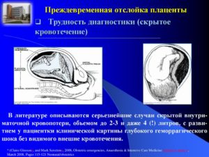 Отек плаценты при беременности причины