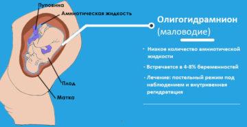 Маловодие при беременности 34 недели что делать