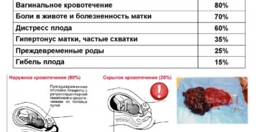 Отслойка плаценты на 20 неделе беременности