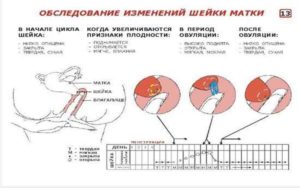 Шейка матки мягкая при беременности 30 недель