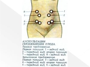 Можно ли почувствовать сердцебиение плода через живот рукой