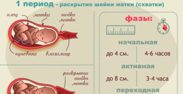 Могут ли начаться потуги без схваток и отхождения вод