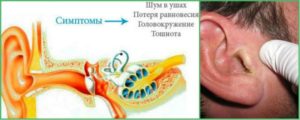 У беременной болит ухо что делать в домашних условиях