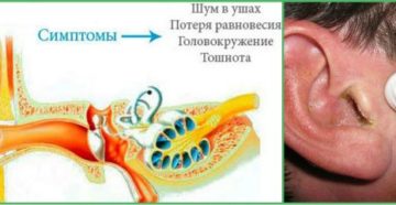 У беременной болит ухо что делать в домашних условиях