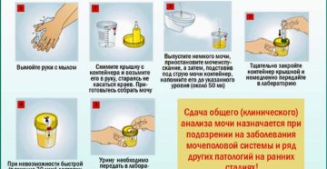 Как правильно сдавать анализ мочи при беременности с ватным тампоном