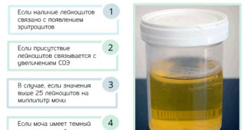 У Ребенка В Моче Повышены Лейкоциты Форум