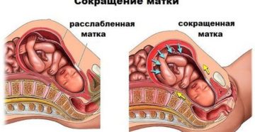 Матка во время беременности сокращается матка