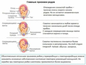 Могут ли быть ложные схватки после отхождения пробки