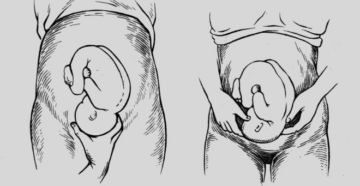 Где ощущаются шевеления при головном предлежании