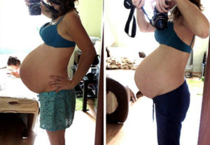 Фото опустился живот при беременности до и после