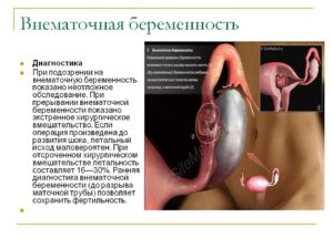 Растет матка при внематочной беременности