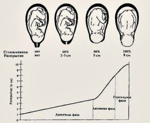 Раскрытие 2 см через сколько начнутся роды у первородящих