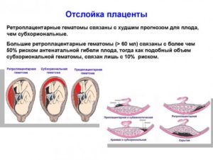 Отслойка и гематома плаценты на ранних сроках беременности