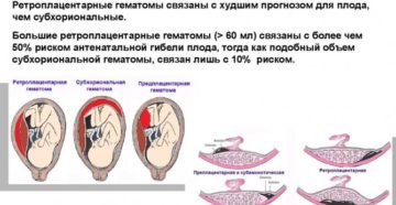 Отслойка и гематома плаценты на ранних сроках беременности