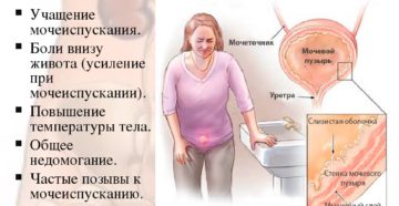 Боли Внизу Живота При Мочеиспускании При Беременности