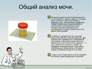 Можно ли пить воду перед сдачей общего анализа мочи