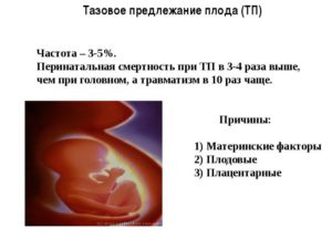 Что значит тазовое предлежание. 31-32 Неделя беременности тазовое предлежание. 27 Недель тазовое предлежание. Предлежание плода в матке. Тазовое предлежание на УЗИ.