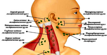 Лимфоузлы На Шее У Ребенка Расположение Фото