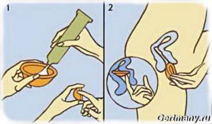 Как вытащить презерватив из влагалища